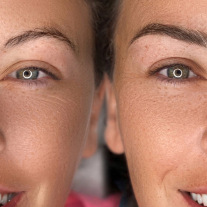 Microblading before after