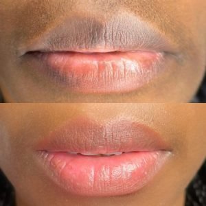 Permanent Make Up For Lips before and after