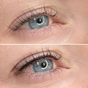 lash line enhancement before after