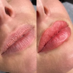 Permanent Make Up For Lips Before and After