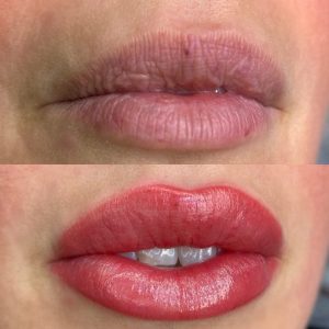 Permanent Make Up For Lips