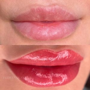 Permanent Make Up For Lips Before and After