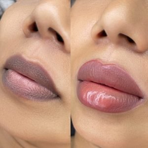 Permanent Make Up For Lips before after